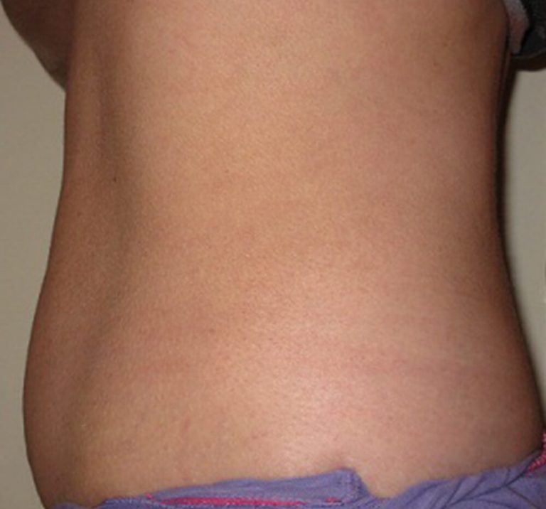 Trusculpt-Photos-a1
