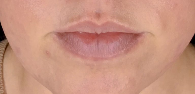 filler-b4